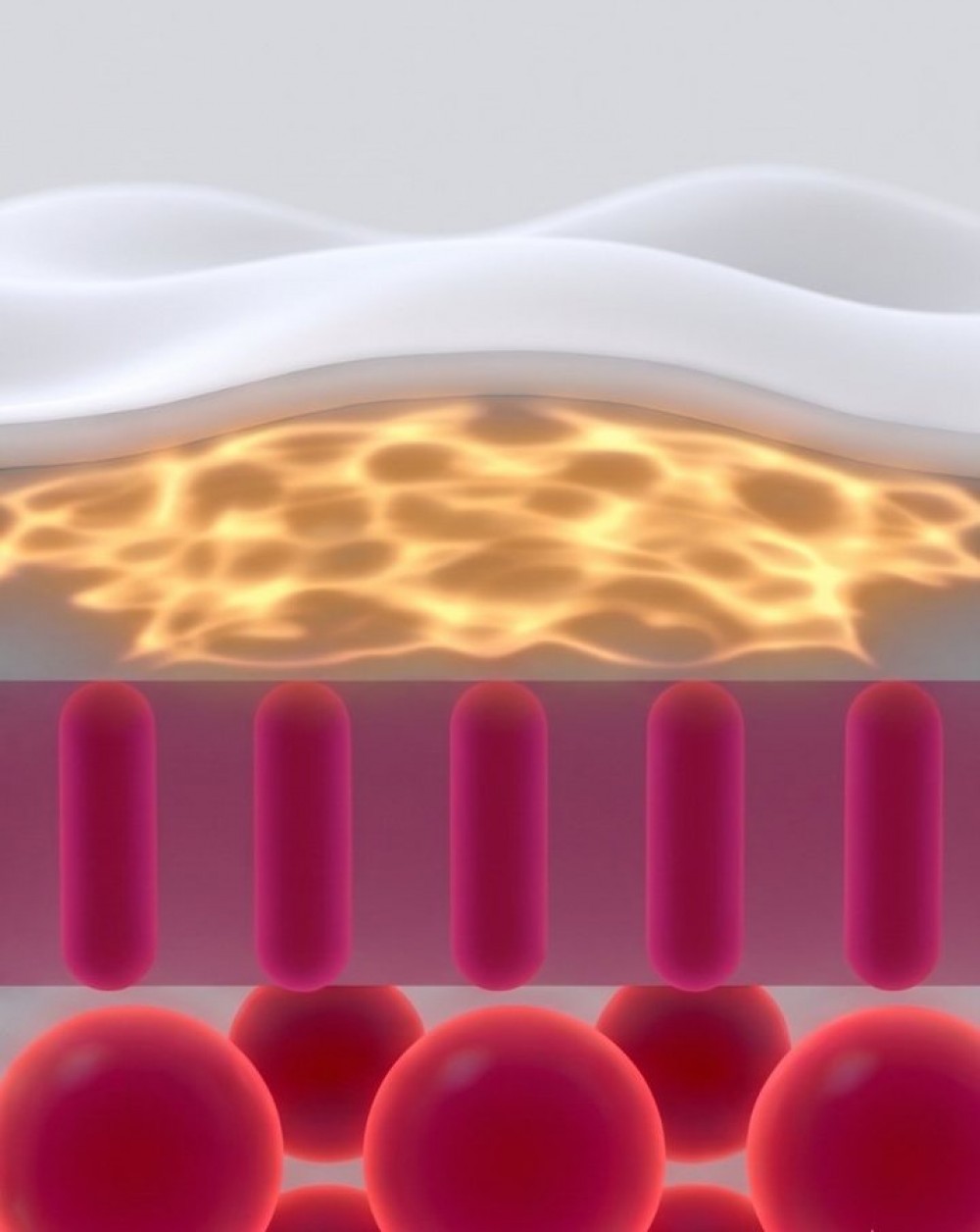 Diodov&yacute; laser s 3D IPL